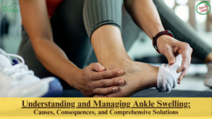 Understanding And Managing Ankle Swelling